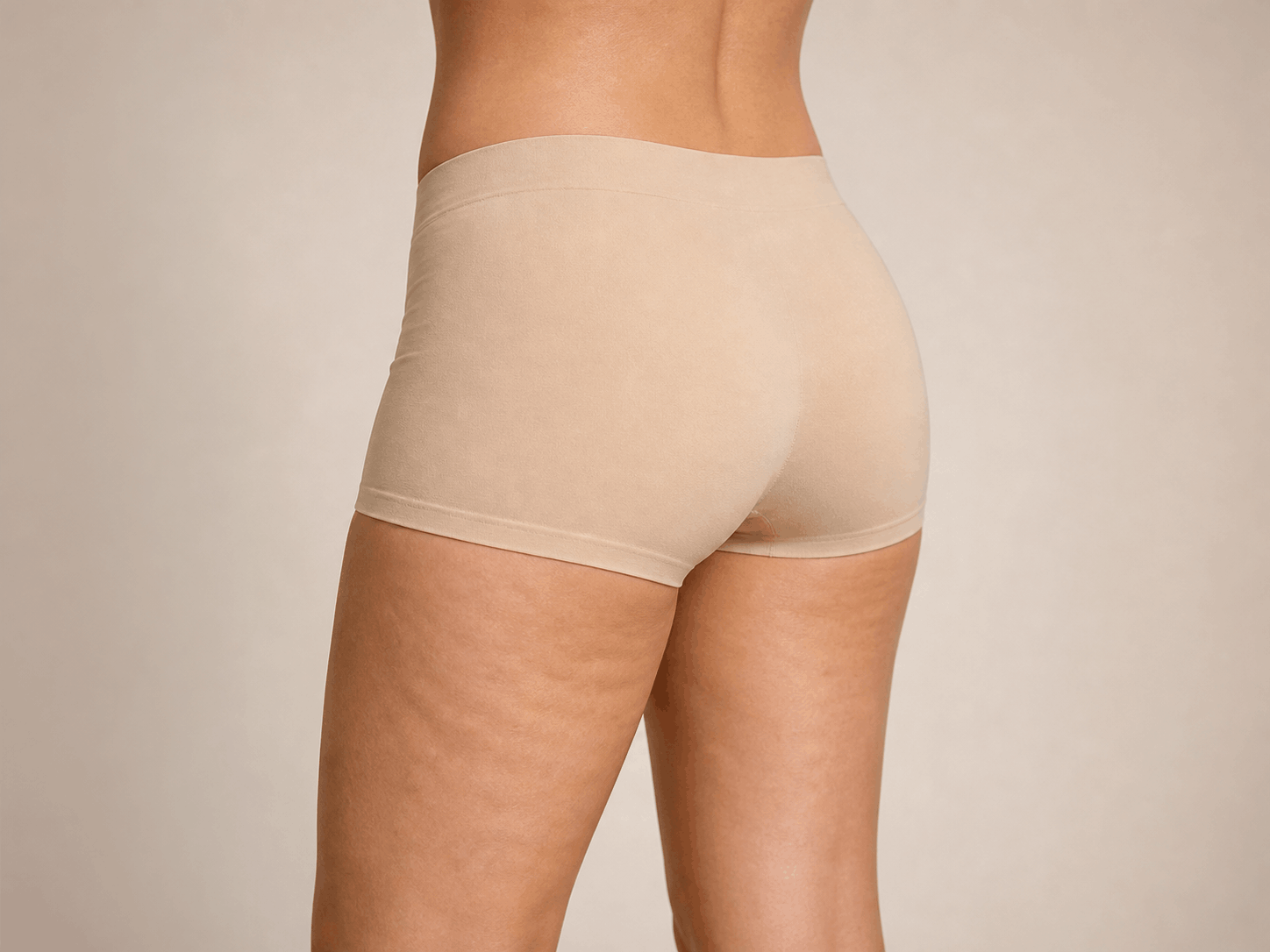 Cellulite